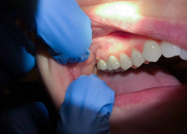 Best Emergency Root Canal Treatment in Midway, UT