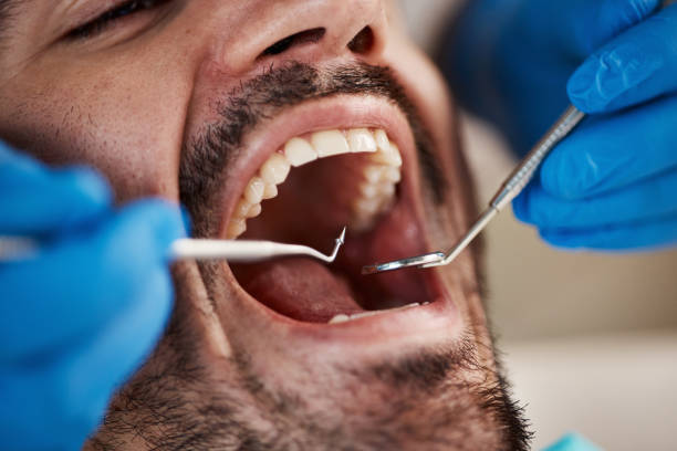 Fast & Reliable Emergency Dental Services in UT